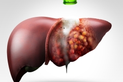 01-Customized-Visuals-Liver-Disease